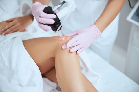 Dermatologische Laserbehandlungen: Ärztin führt eine dermatologische Laserbehandlung am Bein einer Patientin durch.
