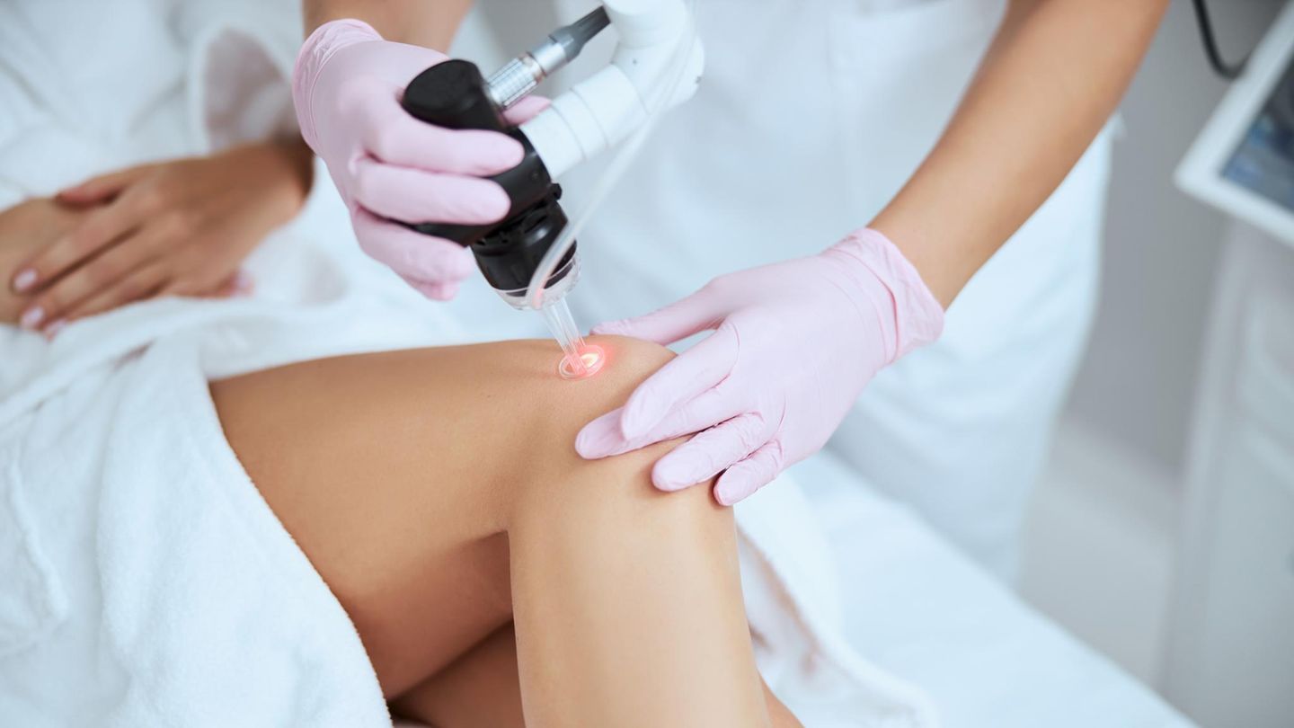 Dermatologische Laserbehandlungen: Ärztin führt eine dermatologische Laserbehandlung am Bein einer Patientin durch.
