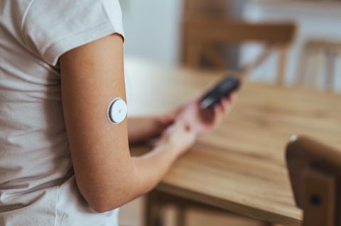 Diabetologie: Blutzuckersensor am Arm, Überwachung des Blutzuckerspiegels per Smartphone.
