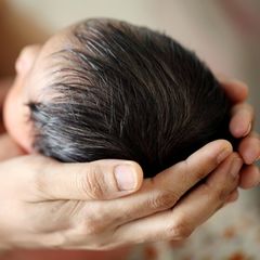 Baby in Indien: In dem Körper des 20 Tage alten Babys befanden sich zwei parasitäre Föten