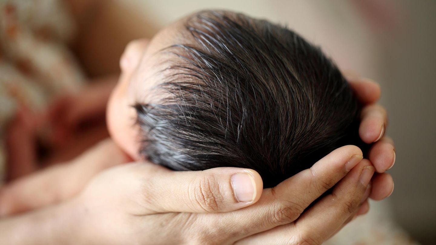 Baby in Indien: In dem Körper des 20 Tage alten Babys befanden sich zwei parasitäre Föten