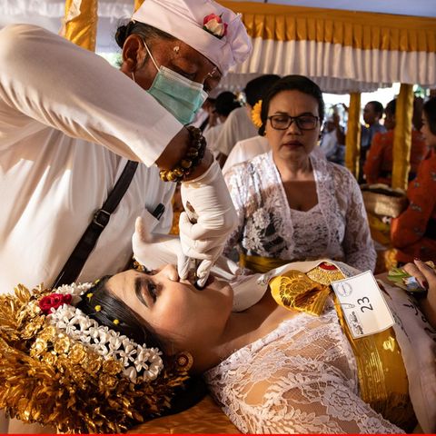 Jembrana, Indonesien. Religionen bringen so manches Ritual hervor, das vielleicht befremdlich erscheint. Hier haben wir es mit der hinduistisch-balinesischen Metatah (Zahnfeilzeremonie) zu tun. Sie wird bei jungen Männern und Frauen abgehalten, die kurz davor stehen, zu heiraten. Im festlichen Rahmen kommt ein Priester ins Haus, der zwei Eckzähne und vier obere Schneidezähne feilt. Ziel ist es, die sechs negativen menschlichen Eigenschaften Wut, Arroganz, Gier, Lust, Neid und Dummheit zu kontrollieren und ein besserer Mensch zu werden