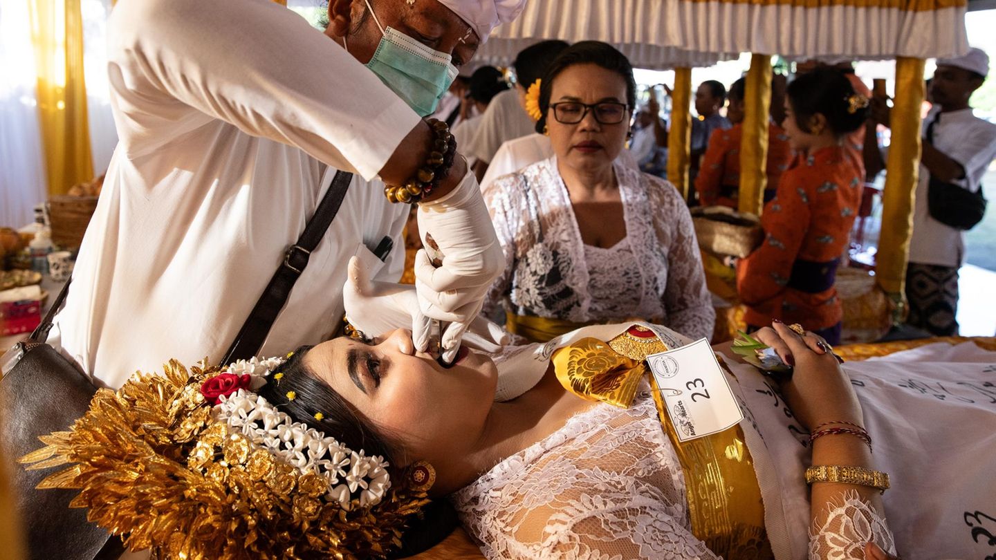 5. September: Zähne Gottes Jembrana, Indonesien. Religionen bringen so manches Ritual hervor, das vielleicht befremdlich erscheint. Hier haben wir es mit der hinduistisch-balinesischen Metatah (Zahnfeilzeremonie) zu tun. Sie wird bei jungen Männern und Frauen abgehalten, die kurz davor stehen, zu heiraten. Im festlichen Rahmen kommt ein Priester ins Haus, der zwei Eckzähne und vier obere Schneidezähne feilt. Ziel ist es, die sechs negativen menschlichen Eigenschaften Wut, Arroganz, Gier, Lust, Neid und Dummheit zu kontrollieren und ein besserer Mensch zu werden