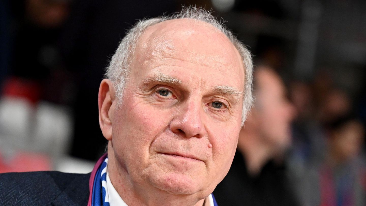 After Slovakia’s bankruptcy: Hoeneß via national team: Do not break the staff over Nagelsmann