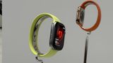 Die Apple Watch Series 11 hat dasselbe Design wie der Vorgänger, soll aber nun besonders kratzfest sein. Die Mobilfunkversion unterstützt nun 5G. Spannend ist die Blutdruckerkennung, die nach monatelanger Beobachtung warnt, wenn Verdacht auf Hochdruck besteht