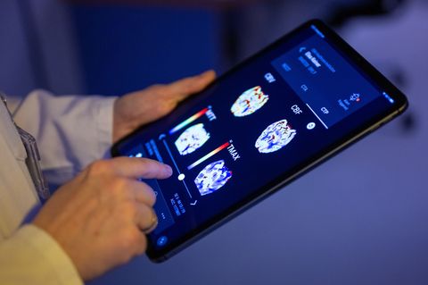 Gehirnbilder eines Patienten in einer KI-basierten App. Nach einer Deloitte-Umfrage sehen viele Bürgerinnen und Bürger den Einsa