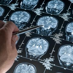 Interventionelle Radiologie: Bildgebendes Diagnostikverfahren in der Radiologie