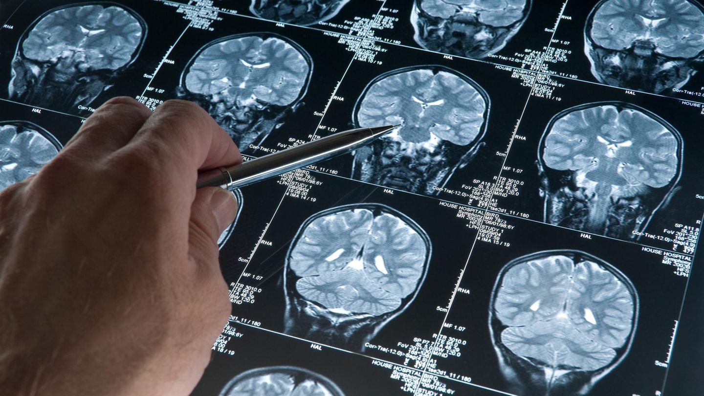Interventionelle Radiologie: Bildgebendes Diagnostikverfahren in der Radiologie
