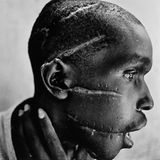 Die Narben im Gesicht dieses Mannes, der zur Volksgruppe der Hutu gehört, sind die Folge eines Macheten-Angriffs. Die Aufnahme entsteht am 1. Juni 1994 in einem Krankenhaus in der ruandischen Stadt Nyanza. In der Zeit wüten Hutu-Milizen im ganzen Land und massakrieren Hunderttausende Tutsi und Hutu, die sich mit den Tutsi solidarisch zeigen. Der Schwergezeichnete auf dem Foto war in einem Lager inhaftiert, dem Terror der Milizen schutzlos ausgesetzt