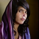 Bibi Aisha, zum Zeitpunkt der Aufnahme am 15. Juli 2010 18 Jahre alt, ist ein Opfer der brutalen Taliban-Herrschaft in Afghanistan. Im Alter von 14 Jahren wird sie gemeinsam mit ihrer jüngeren Schwester nach Paschtunen-Brauch zur Beilegung eines Familienstreits einem Taliban-Kämpfer übergeben. Sie heiratet ihn, flieht und wird bestraft. Die Taliban schneiden ihr Ohren und Nase ab. Sie überlebt und kommt nach Kabul, wo sich die Organisation Women for Afghan Women um sie kümmert. In den USA wird ihr Gesicht später von Ärzten wiederhergestellt