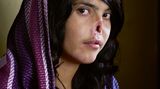 Bibi Aisha, zum Zeitpunkt der Aufnahme am 15. Juli 2010 18 Jahre alt, ist ein Opfer der brutalen Taliban-Herrschaft in Afghanistan. Im Alter von 14 Jahren wird sie gemeinsam mit ihrer jüngeren Schwester nach Paschtunen-Brauch zur Beilegung eines Familienstreits einem Taliban-Kämpfer übergeben. Sie heiratet ihn, flieht und wird bestraft. Die Taliban schneiden ihr Ohren und Nase ab. Sie überlebt und kommt nach Kabul, wo sich die Organisation Women for Afghan Women um sie kümmert. In den USA wird ihr Gesicht später von Ärzten wiederhergestellt