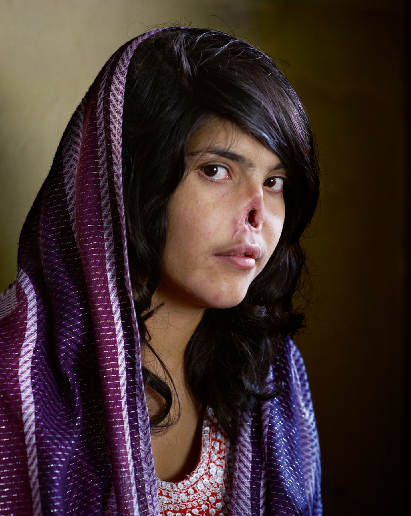 Bibi Aisha, zum Zeitpunkt der Aufnahme am 15. Juli 2010 18 Jahre alt, ist ein Opfer der brutalen Taliban-Herrschaft in Afghanistan. Im Alter von 14 Jahren wird sie gemeinsam mit ihrer jüngeren Schwester nach Paschtunen-Brauch zur Beilegung eines Familienstreits einem Taliban-Kämpfer übergeben. Sie heiratet ihn, flieht und wird bestraft. Die Taliban schneiden ihr Ohren und Nase ab. Sie überlebt und kommt nach Kabul, wo sich die Organisation Women for Afghan Women um sie kümmert. In den USA wird ihr Gesicht später von Ärzten wiederhergestellt