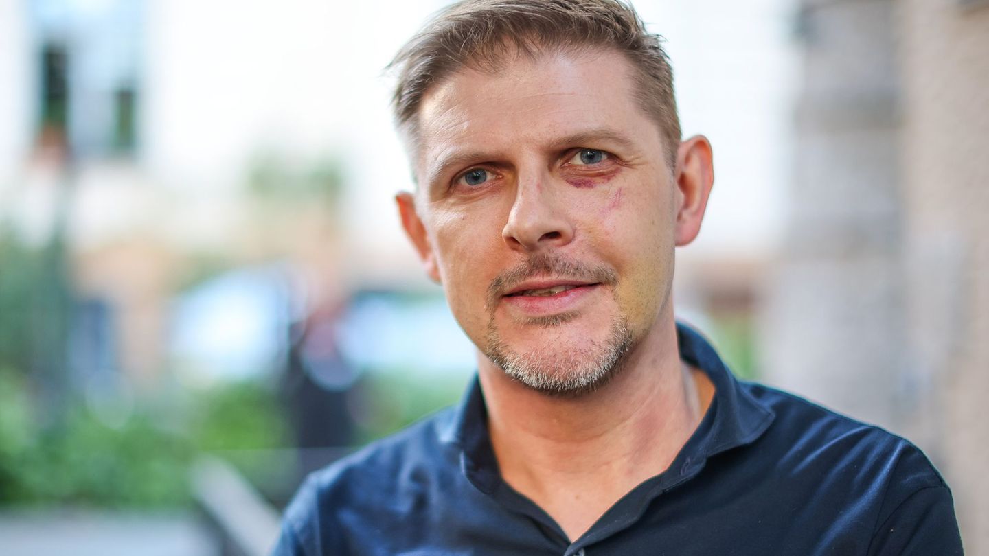 Matthias Ecke (SPD) wurde am 3. Mai beim Aufhängen von Wahlplakaten angegriffen. (Archivbild) Foto: Jan Woitas/dpa