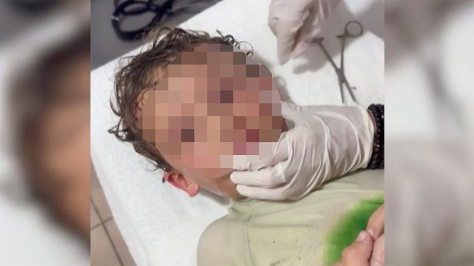 Junge mit Krabbe im Ohr Junge klagt über Schmerzen nach Baden im Meer – Arzt entfernt Krabbe aus Ohr