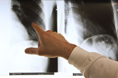 Wie kann ich Rheuma vorbeugen und wie kann die Behandlung von Betroffenen verbessert werden? Solche Fragen soll der Aktionsplan