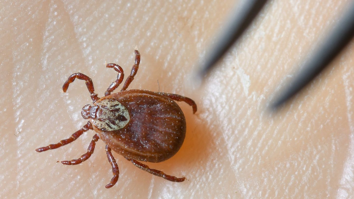 Borreliose wird durch Zeckenbisse übertragen. (Symbolbild) Foto: Patrick Pleul/dpa-Zentralbild/dpa