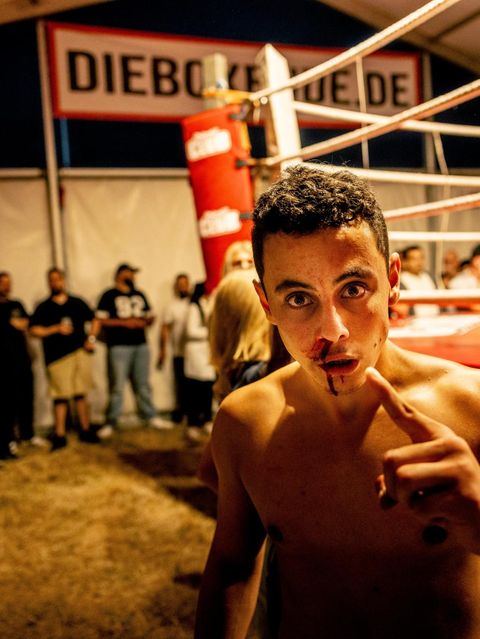 Boxbude: Teilnehmer Nefah nach dem Kampf mit blutiger Nase