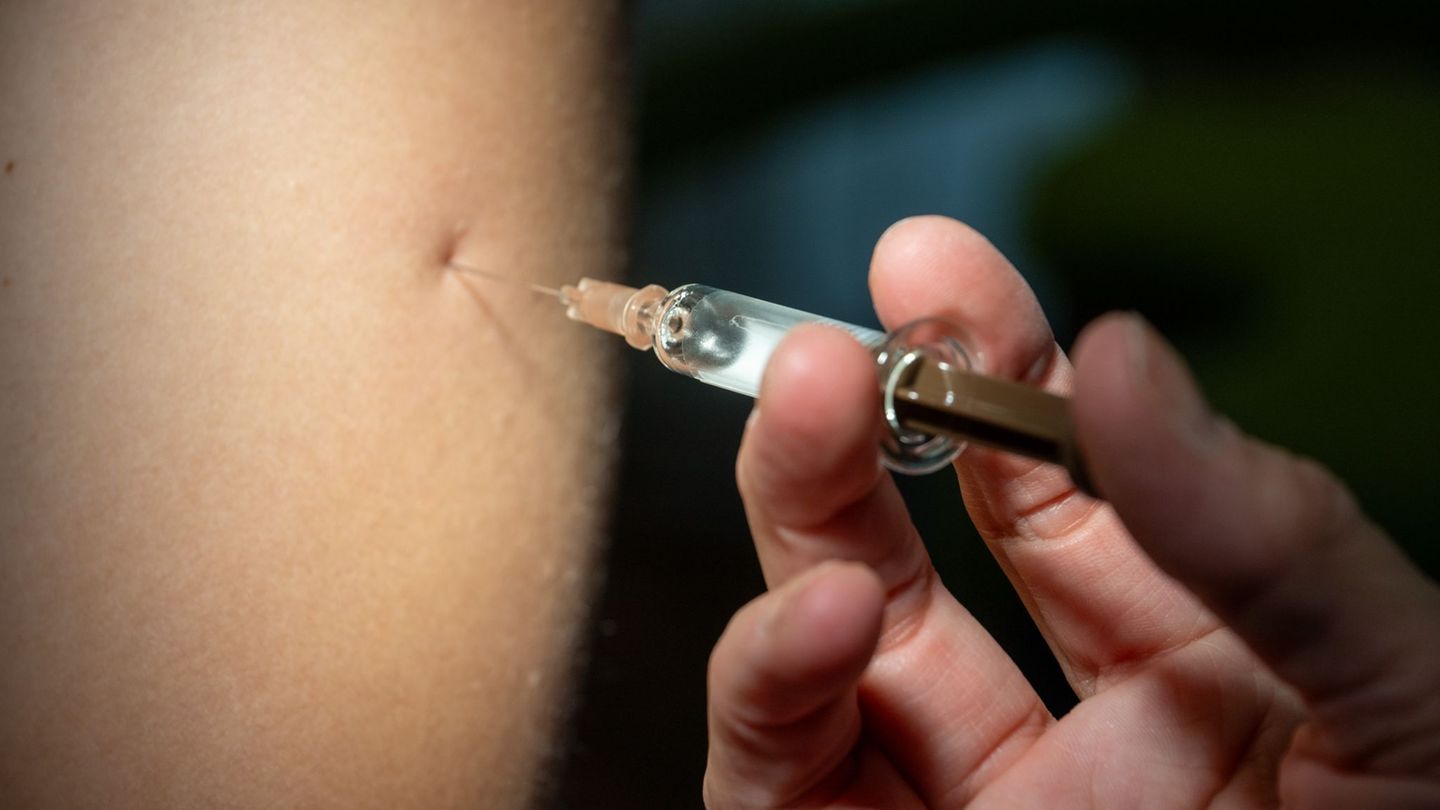 Das Virus löst vor allem Hautausschlag aus, aber auch Fieber und Muskelschmerzen. (Symbolbild) Foto: Stefan Puchner/dpa