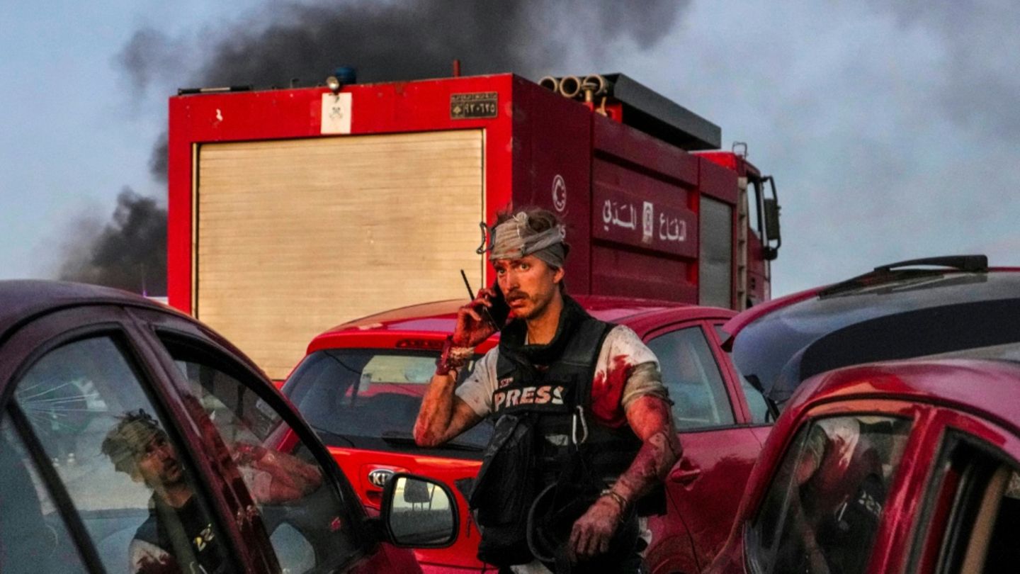 AFP-Journalist Dylan Collins nach dem Angriff