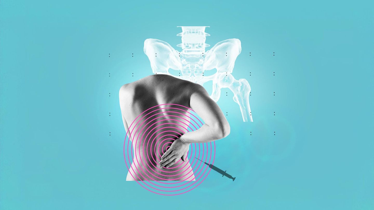 Rückenschmerz: Illustration einer Frau, die sich den Rücken hält Rückenschmerz: Illustration einer Frau, die sich den Rücken hält