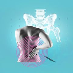 Rückenschmerz: Illustration einer Frau, die sich den Rücken hält