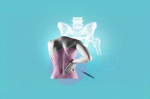 Rückenschmerz: Illustration einer Frau, die sich den Rücken hält