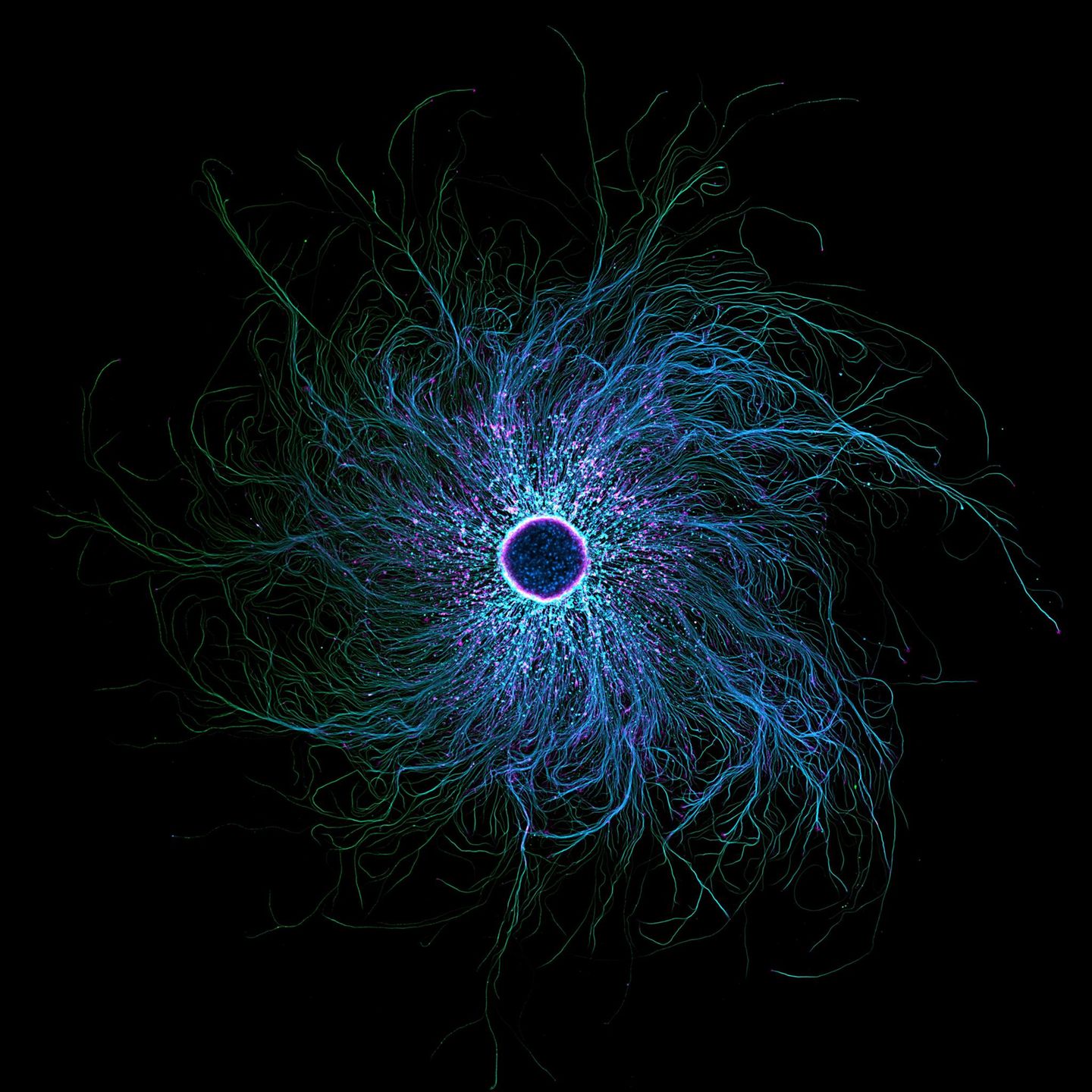 Nervenzellen aus der Retorte Aus iPSC gewonnene sensorische Neuronen, markiert zur Darstellung von Tubulin und Aktin – Fotografie