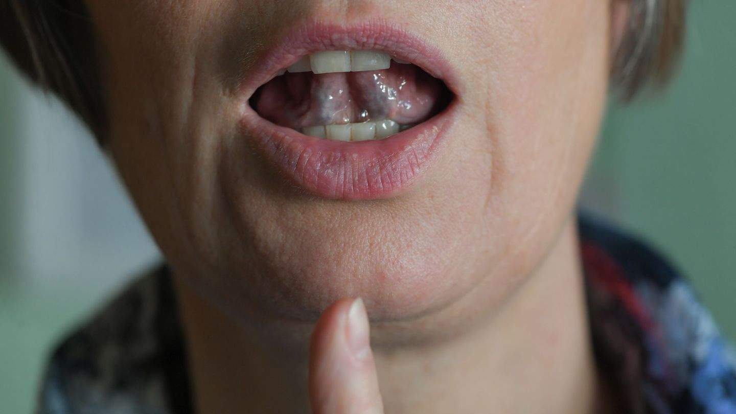 Stotternde Menschen können mit Hilfe von regelmäßigen Sprechübungen ihren Redefluss verbessern. (Symbolbild) Foto: Jens Kalaene/