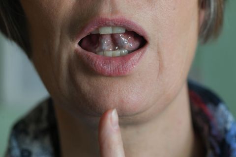 Stotternde Menschen können mit Hilfe von regelmäßigen Sprechübungen ihren Redefluss verbessern. (Symbolbild) Foto: Jens Kalaene/