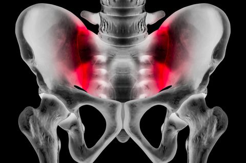 Rückenschmerz ausgelöst durch das Iliosakralgelenk: anatomische Darstellung des Gelenks Rückenschmerz ausgelöst durch das Iliosakralgelenk: anatomische Darstellung des Gelenks