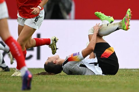 Kreuzbandrisse im Frauen-Fußball: Lena Oberdorf hält sich das Knie