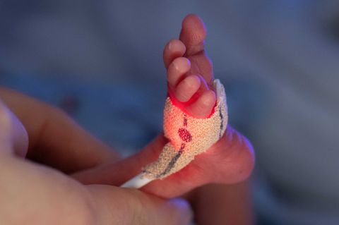 In Magdeburg wurde ein Baby mit nur 300 Gramm geboren und erfolgreich gepflegt. (Symbolbild) Foto: Boris Roessler/dpa