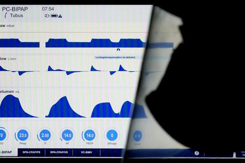 Monitor in Krankenhaus