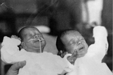 DDR-Zwangsadoptionen: Betroffene sucht ihren Zwilling