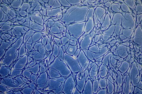 Proben kultivierter Fischzellen sind auf einem Monitor eines Mikroskops zu sehen. (Archivbild) Foto: Axel Heimken/dpa