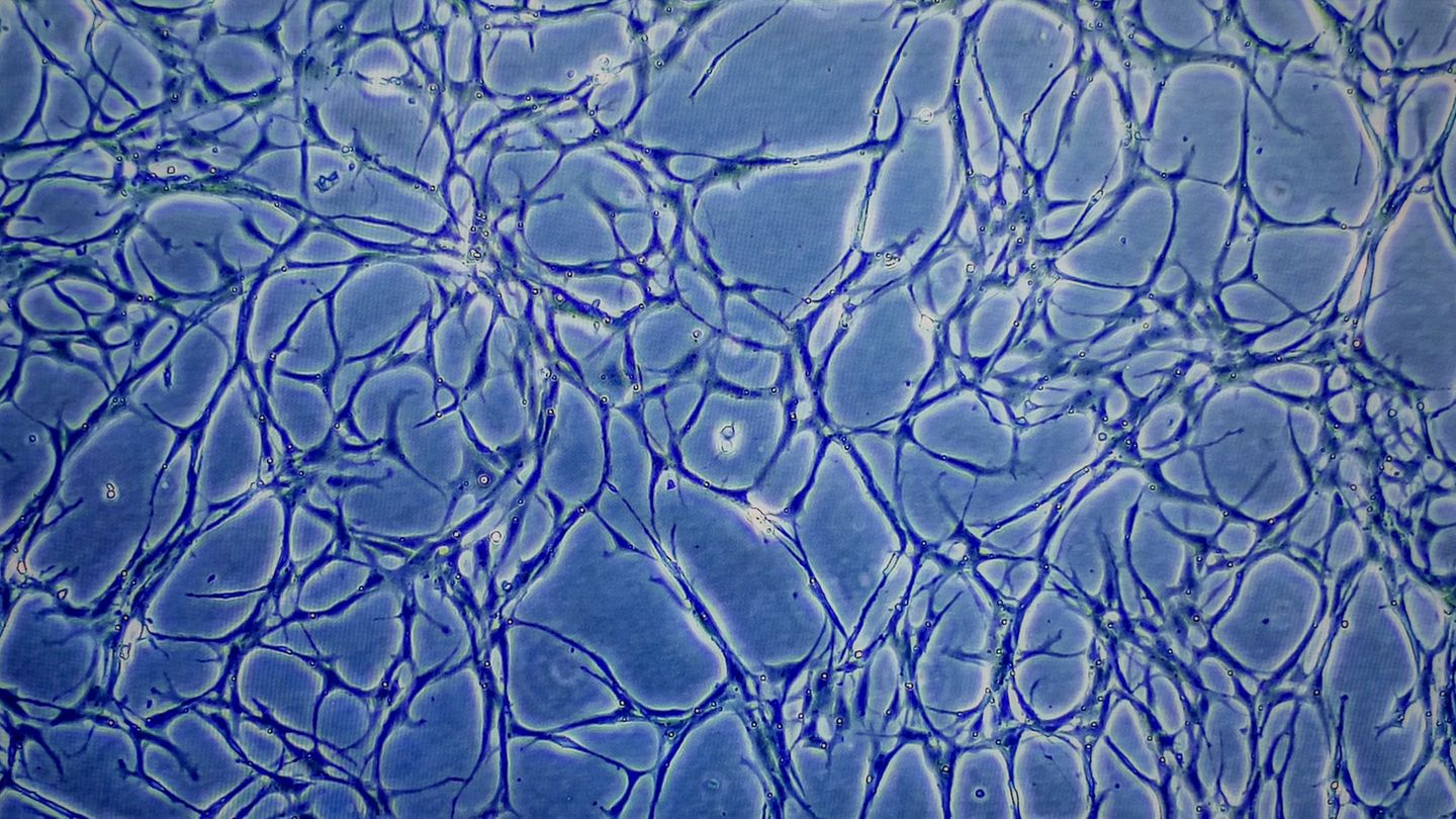 Lebensmittel: Konsumenten laut Forscherin offen für Fisch aus dem Labor