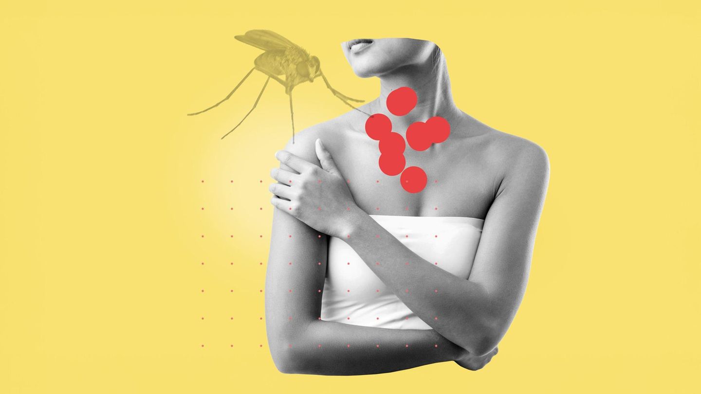 Die Diagnose: Mysteriöse Hautflecken: Was haben die Urlaube der Patientin damit zu tun?