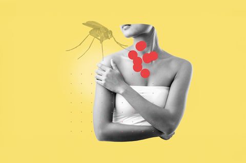 Kollage: Frau mit roten Hautflecken und Mücke