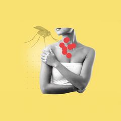 Kollage: Frau mit roten Hautflecken und Mücke