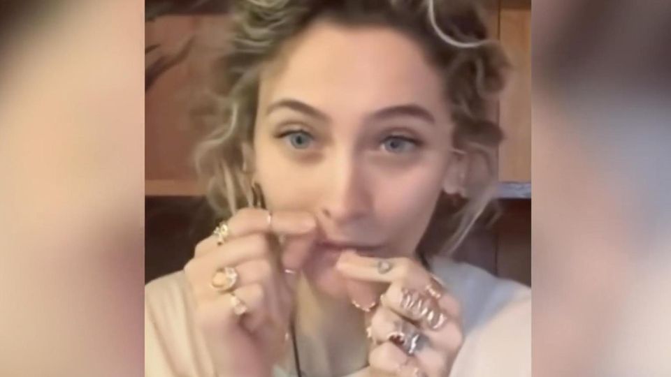 Paris Jackson zeigt: Dieses Loch ätzten Drogen in ihre Nasenscheidewand