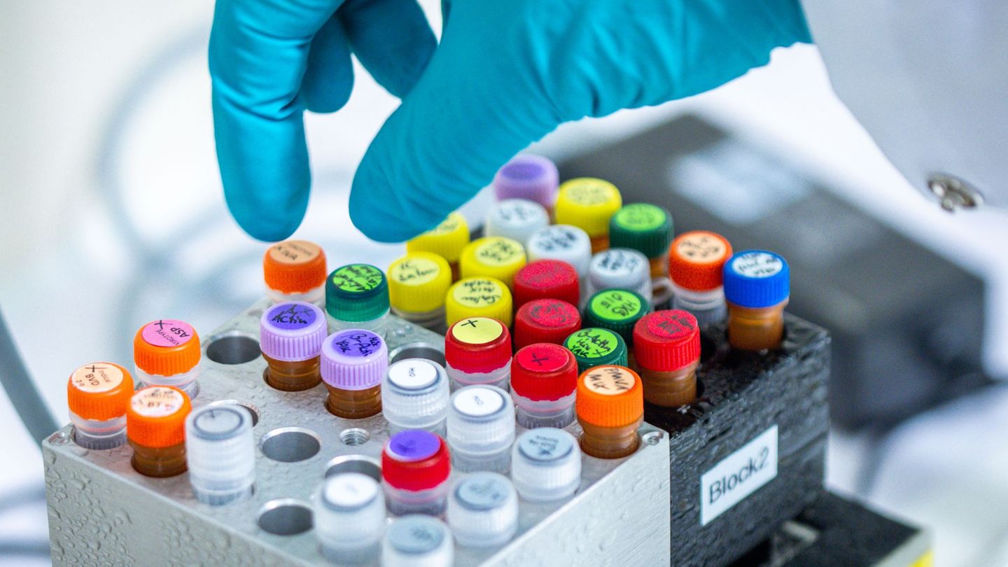 Ehec bezeichnet bestimmte krankmachende Stämme des Darmbakteriums, die vor allem bei Wiederkäuern wie Rindern vorkommen. (Archiv