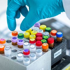 Ehec bezeichnet bestimmte krankmachende Stämme des Darmbakteriums, die vor allem bei Wiederkäuern wie Rindern vorkommen. (Archiv