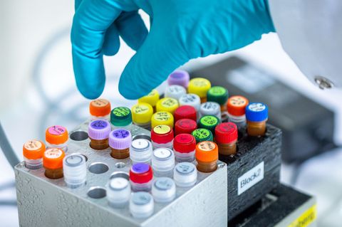 Ehec bezeichnet bestimmte krankmachende Stämme des Darmbakteriums, die vor allem bei Wiederkäuern wie Rindern vorkommen. (Archiv