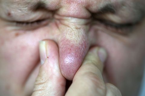 Am Untermain kommen Experten dem zeitweiligen Gestank bisher nicht auf die Spur. (Symbolbild) Foto: Oliver Berg/dpa