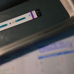 HIV-Diagnosen werden oft erst Jahre nach der Infektion gestellt. (Symbolbild) Foto: Sebastian Gollnow/dpa