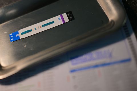 HIV-Diagnosen werden oft erst Jahre nach der Infektion gestellt. (Symbolbild) Foto: Sebastian Gollnow/dpa