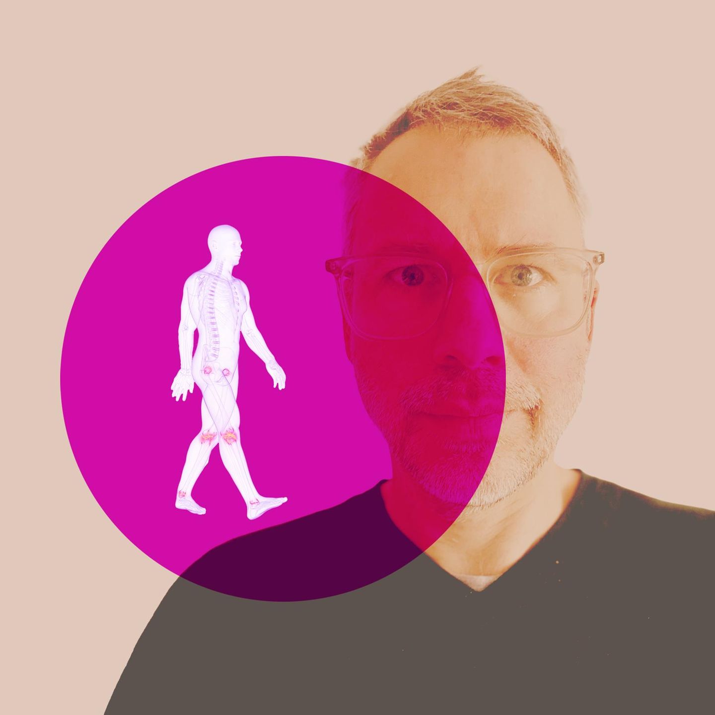 Meine Heilung: Symbolbild Rheuma