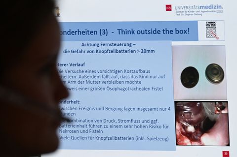 Mal werden Informationen zu Batterie-Knopfzellen benötigt, mal zu Inhaltsstoffen von verschlucktem Reinigungsmittel. (Archivbild