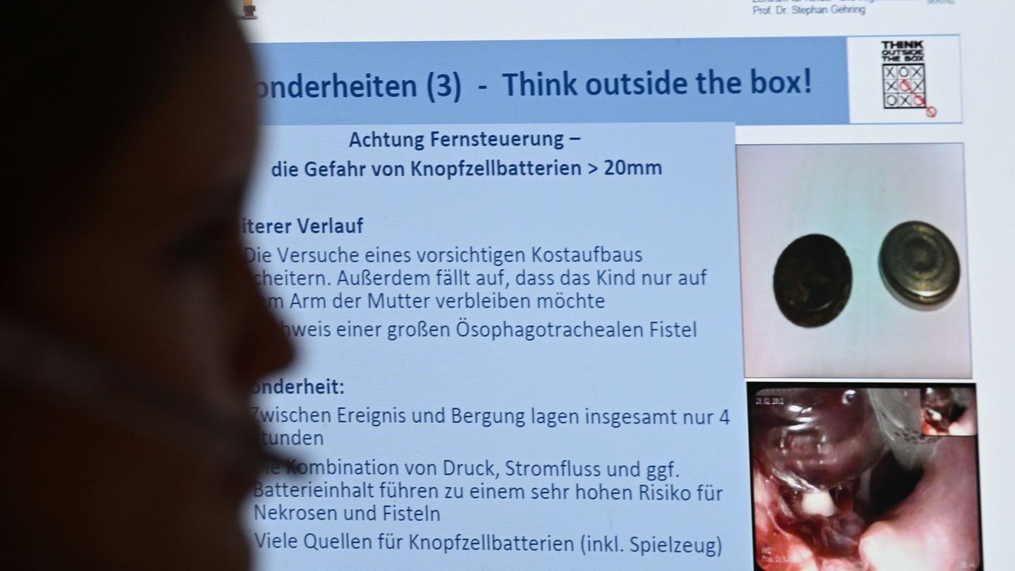 Mal werden Informationen zu Batterie-Knopfzellen benötigt, mal zu Inhaltsstoffen von verschlucktem Reinigungsmittel. (Archivbild