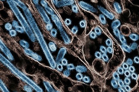 2025 erkrankten über 70 Menschen an Vogelgrippe in den USA